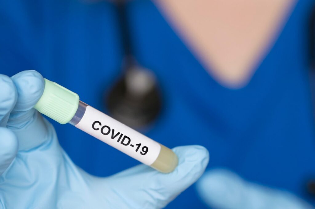 Ponad 24 tys. nowych przypadków koronawirusa. 574 osoby zmarły Radio Zachód - Lubuskie