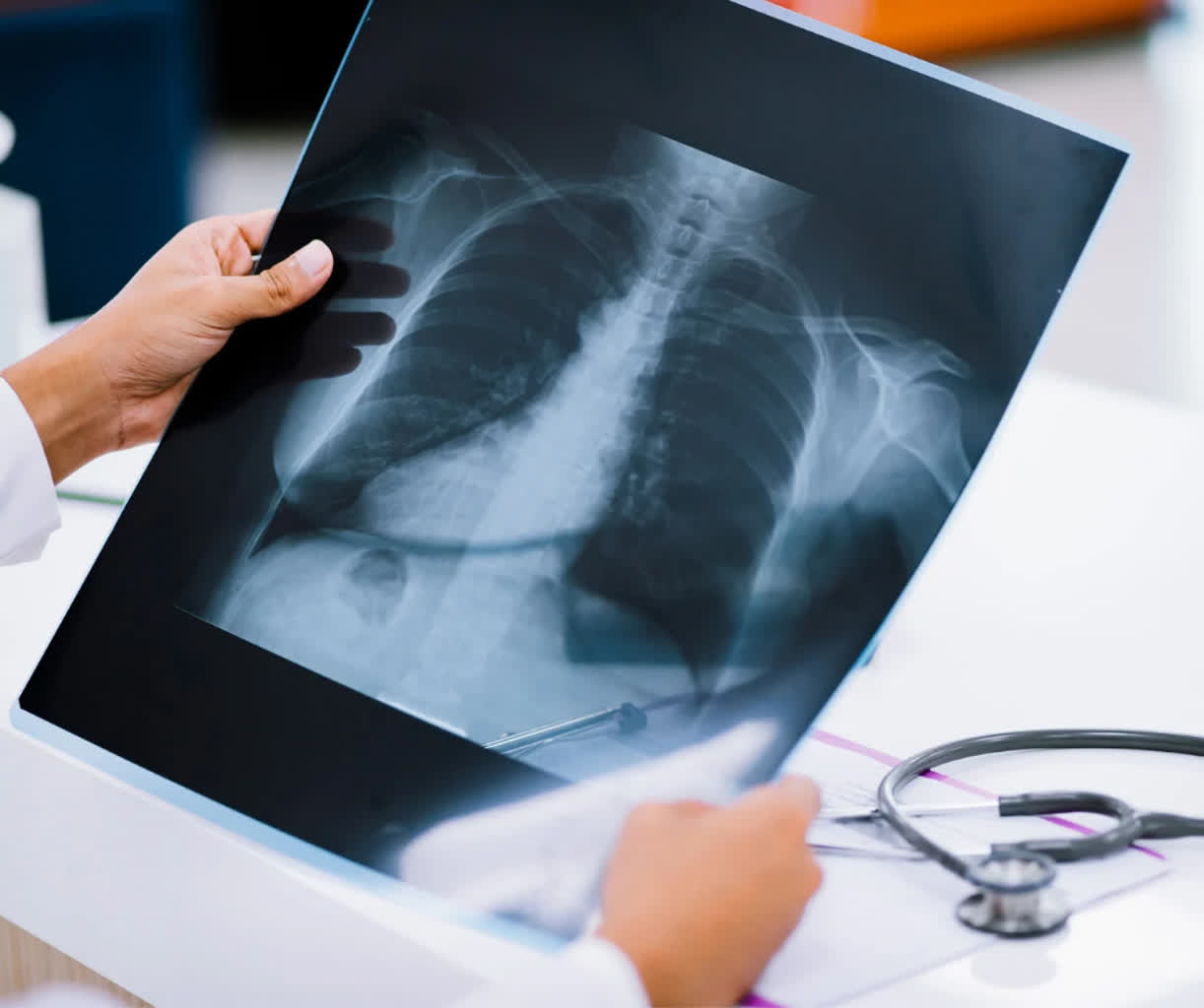 Sztuczna inteligencja pomoże ocenić zdrowie płuc Radio Zachód - Lubuskie