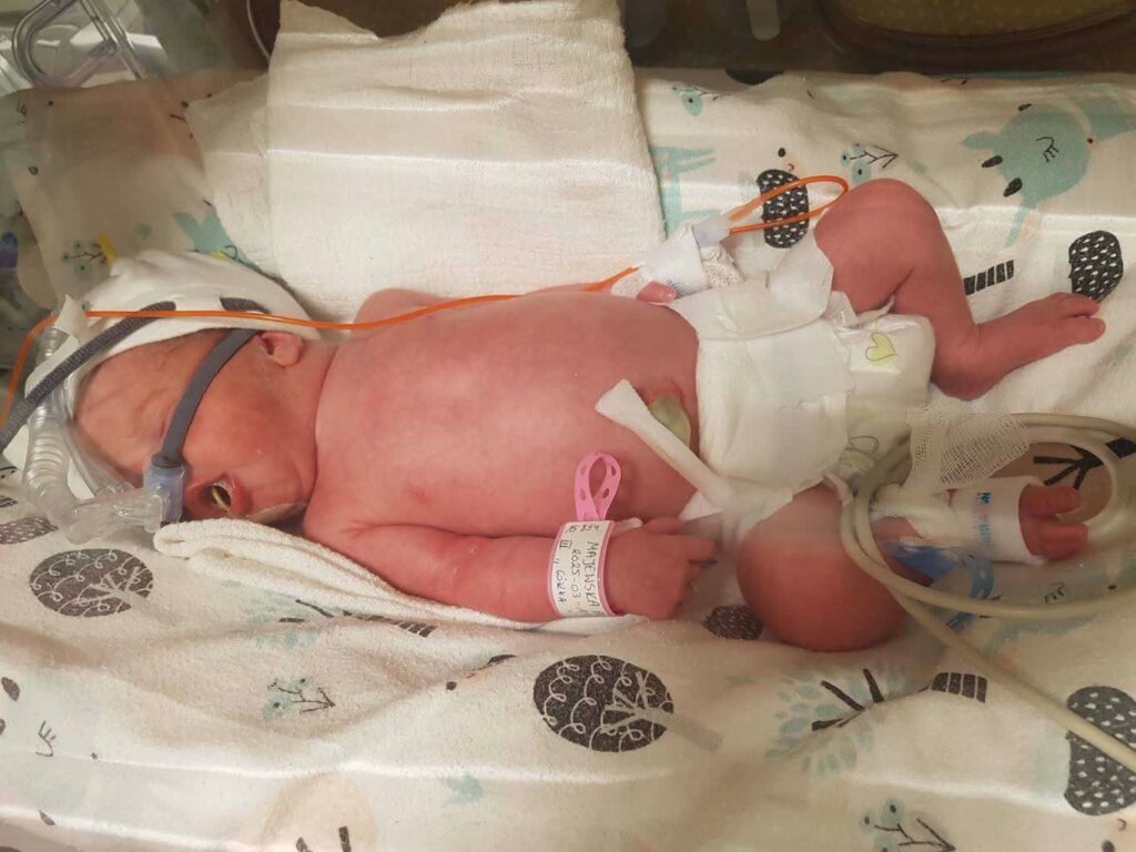 foto: szpital uniwersytecki w ZG