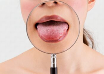 Owrzodzenie na języku – 5 sprawdzonych sposobów na radzenie sobie z problemem Radio Zachód - Lubuskie