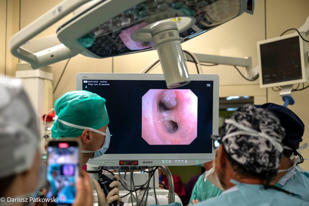 Mała Hania nie oddychała przez 2,5 godziny. Skomplikowana operacja wrodzonej wady tchawicy przywróciła jej oddech Radio Zachód - Lubuskie