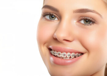 Czy szczoteczka soniczna jest dobra dla osób z aparatem ortodontycznym? Radio Zachód - Lubuskie