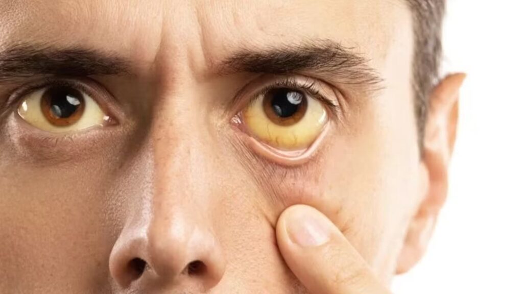 W Pradze spadła dynamika zakażeń wirusowym zapaleniem wątroby typu A. Polskie MSZ nie odradza podróży do Czech 3 Zdjęcie ilustracyjne. Fot. Freepik