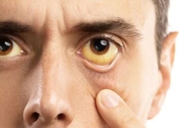 Zdjęcie ilustracyjne. Fot. Freepik